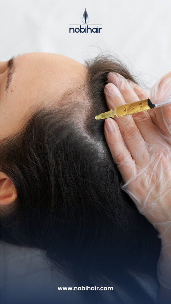 Nobi Hair Clinic | Trapianto Capelli Albania | Hair Transplant Albania gallery photo