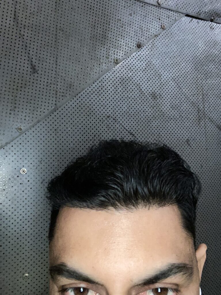 Neograft Hair Clinic gallery photo
