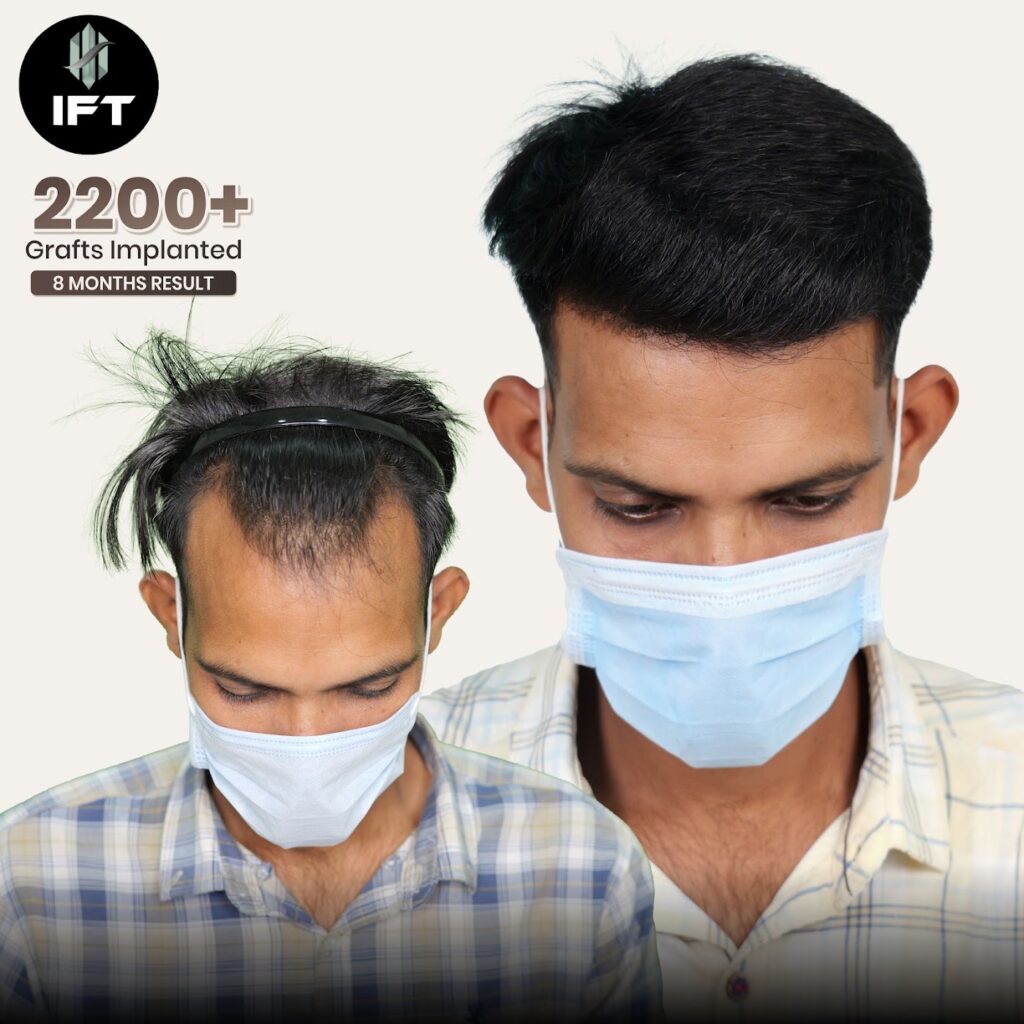 IFT Hair Science gallery photo
