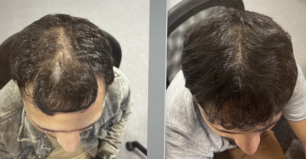 Premier Hair Restoration Clinic gallery photo