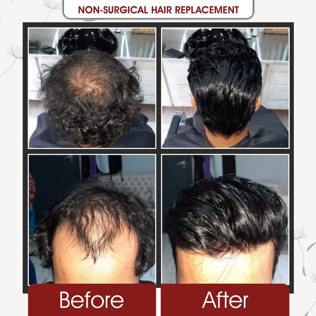 Grace Follicles (Durban Hair Loss Clinic) gallery photo