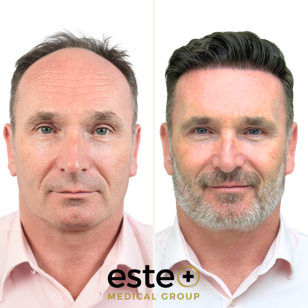 Este Medical Group- Hair & Skin Clinic Glasgow — clinic photo from Google Maps