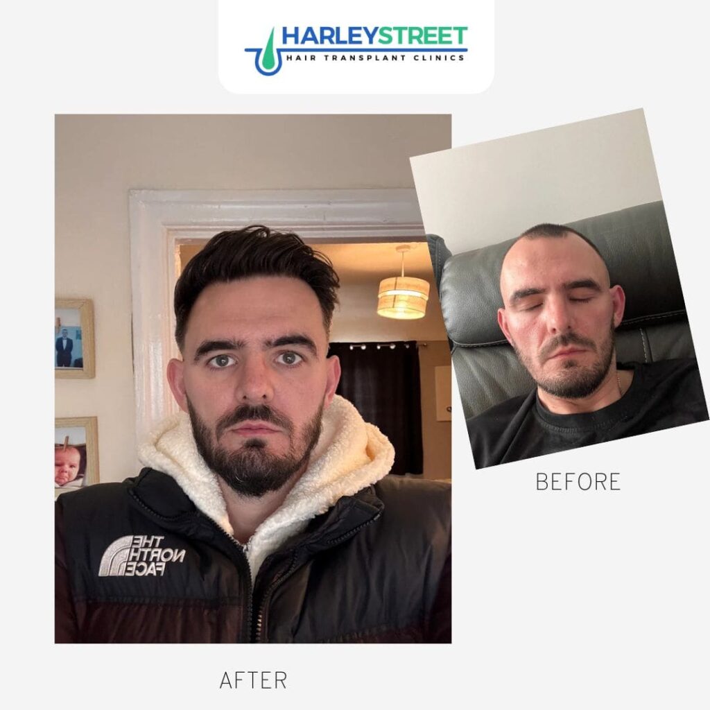 Manchester Hair Transplant Clinic gallery photo