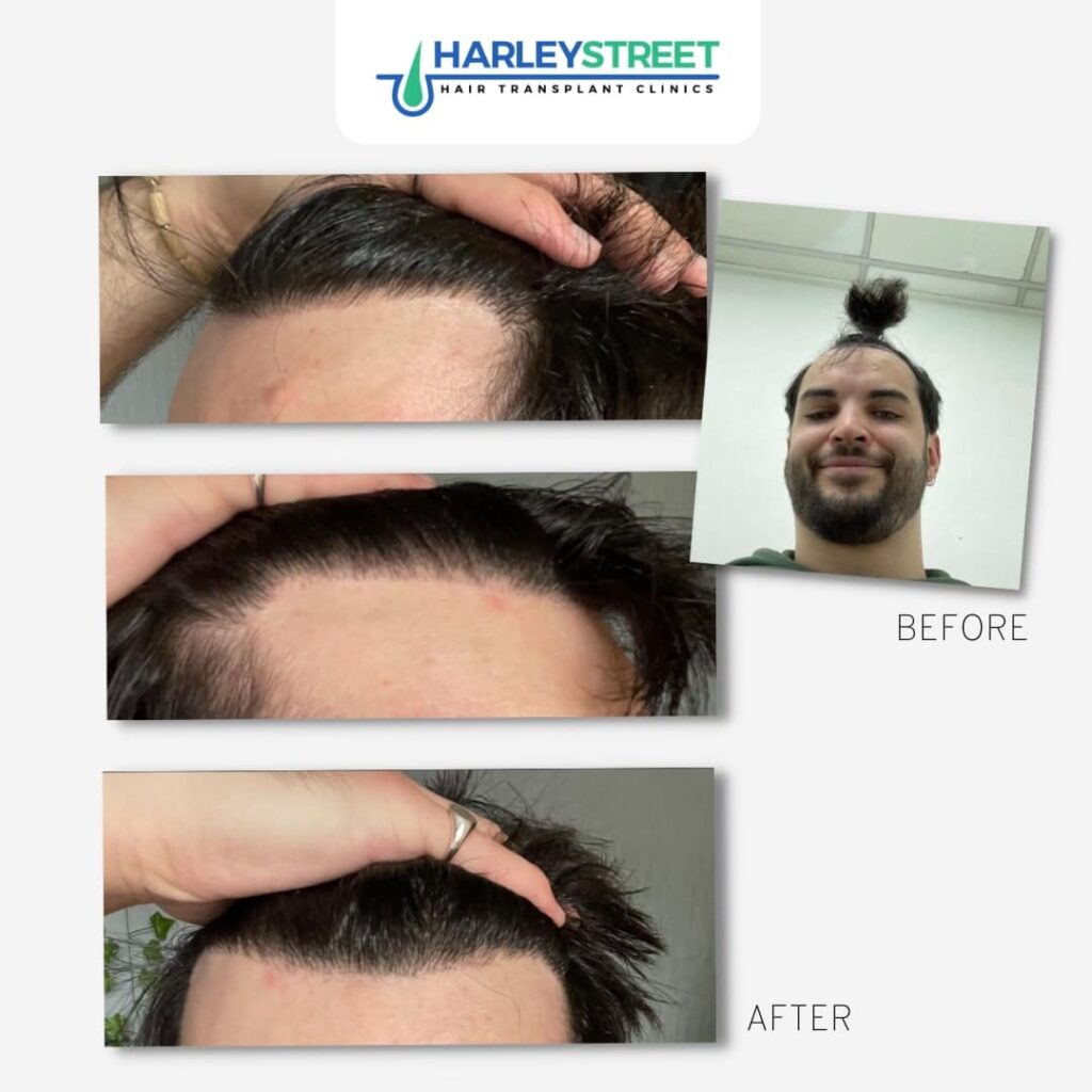 Manchester Hair Transplant Clinic gallery photo