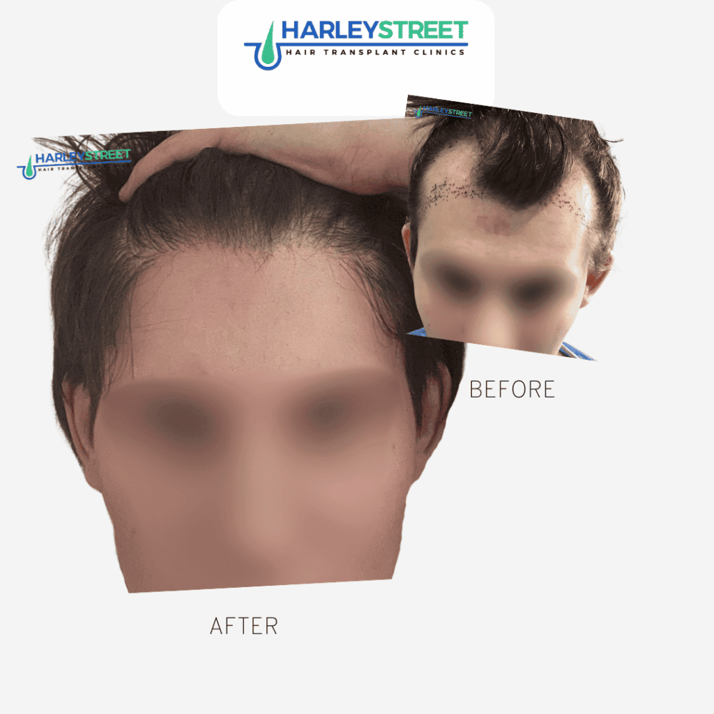 Manchester Hair Transplant Clinic gallery photo