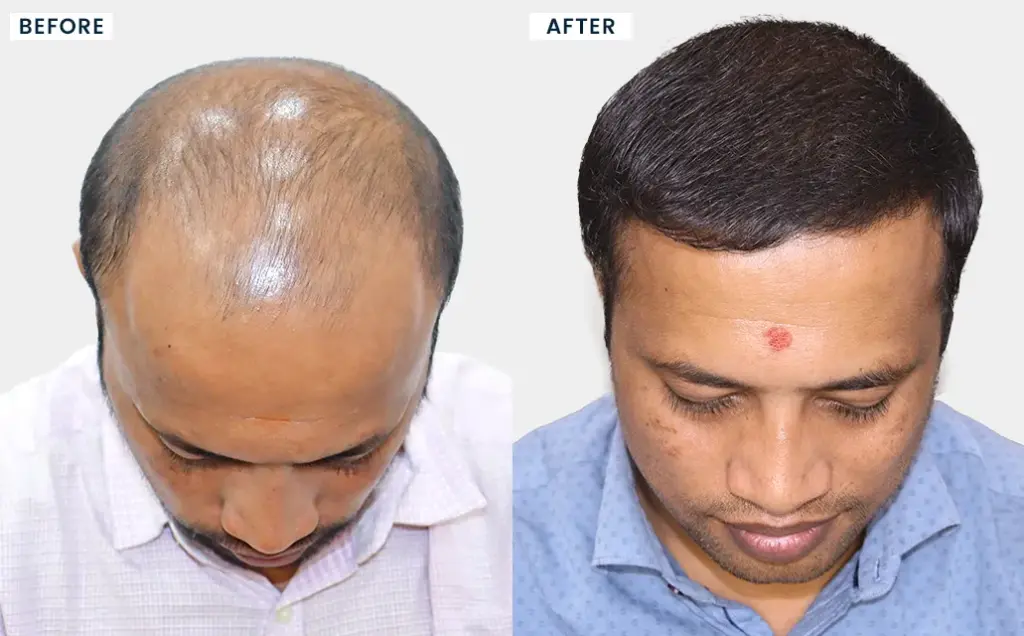 Hairfree & Hairgrow Mumbai gallery photo