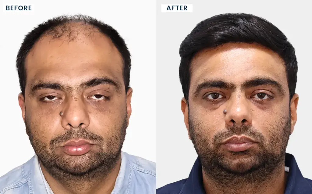 Hairfree & Hairgrow Mumbai gallery photo