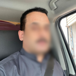 Hair Transplant Islamabad – Hairhub gallery photo