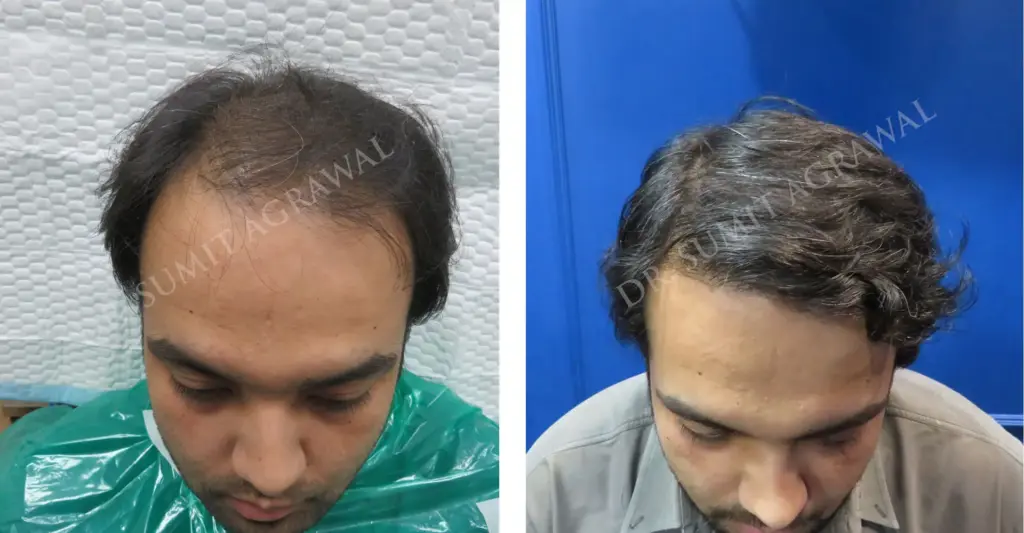 Harleys Hair Transplant Clinic gallery photo