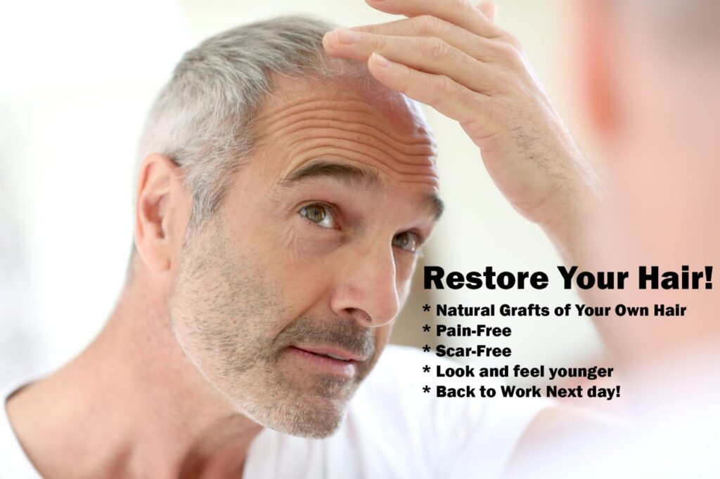 NeoGraft Hair Restoration Orange County gallery photo