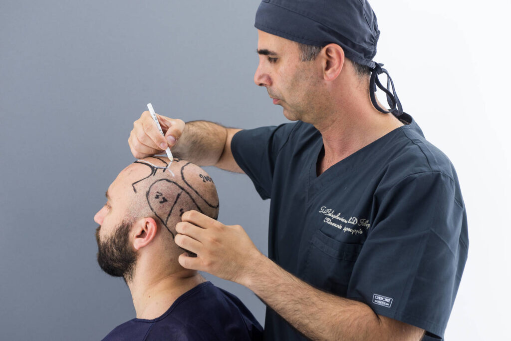 THE ANTIAGERS reGrow Hair Clinic Athens gallery photo