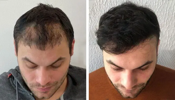 Saee Skin and Hair Clinic Tehran gallery photo