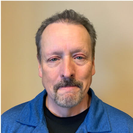 Hair Restoration Seattle – Dr. Javad Sajan gallery photo