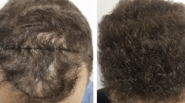 USA Hair Clinic gallery photo